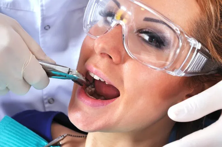 A woman in protective glasses with her mouth open as a gloved hand holds dental forceps