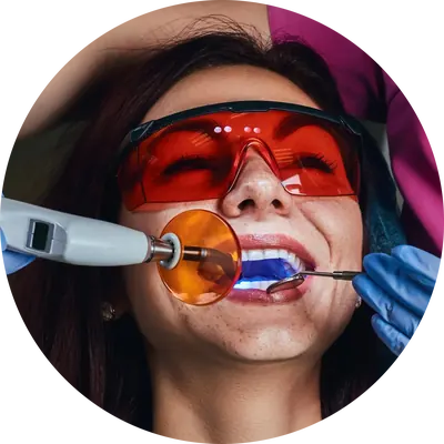 Dentist placing a light-cured tooth filling