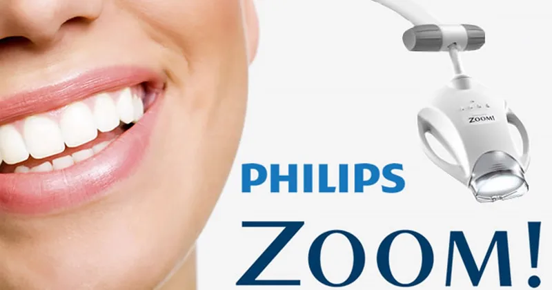 A white smile beside a teeth whitening lamp