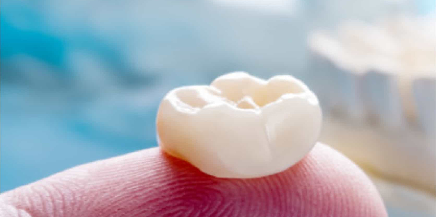 A single tooth-coloured crown resting on a fingertip